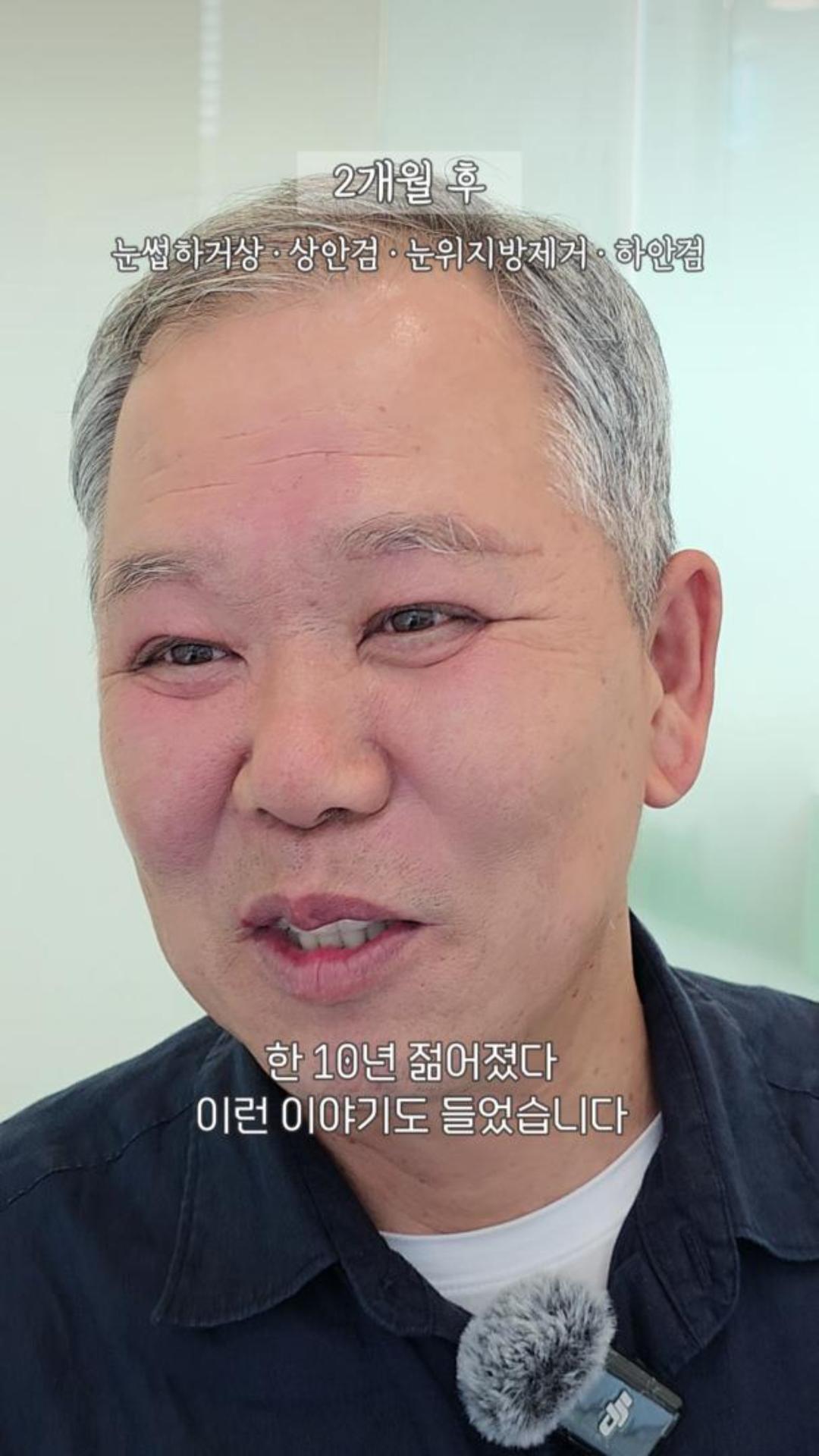 짓무르던 눈위와 주름진 눈밑, 60대 남성의 2개월 후 변화