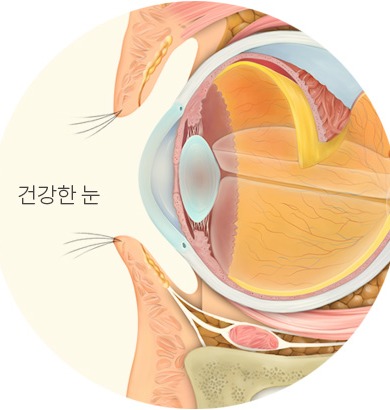 건강한 눈 단면 비교