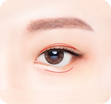 수술 부위 디자인