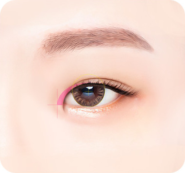디자인 - 앞트임