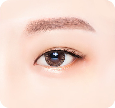 수술 후 - 위트임
