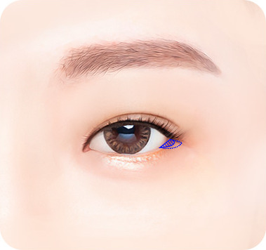 디자인 - 뒤트임