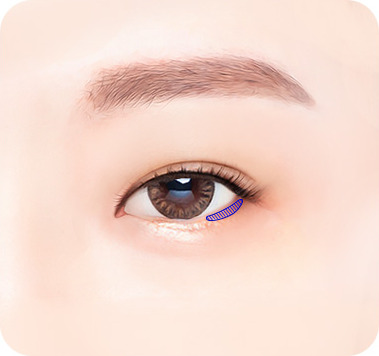 디자인 - 밑트임