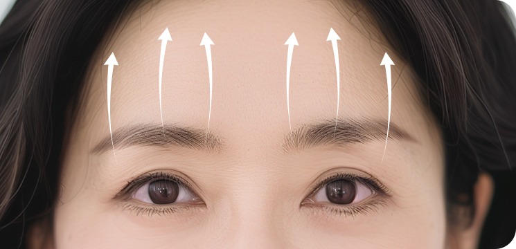 이마거상술 전반적인 상안면부 주름과 처짐 개선