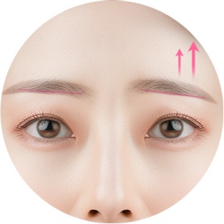 비대칭 눈썹을 균형 있게 교정한 모습
