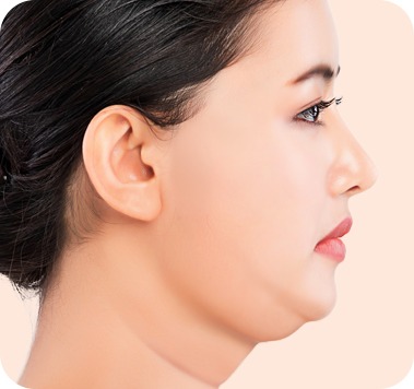 수술 전