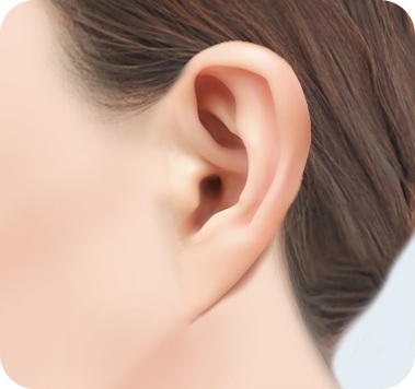 거상 후 칼귀가 발생한 상태