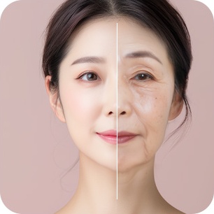 노화도 분석