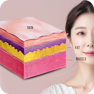 근막층, 피부 탄력도 분석