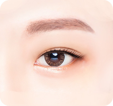 수술 후