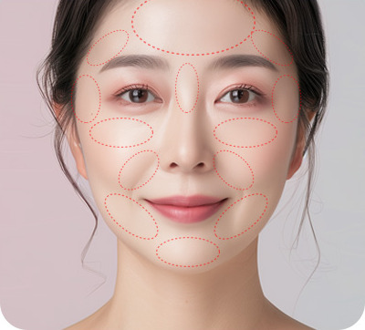 얼굴 여러 부위 시술