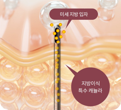 전용 캐뉼라 지방이식