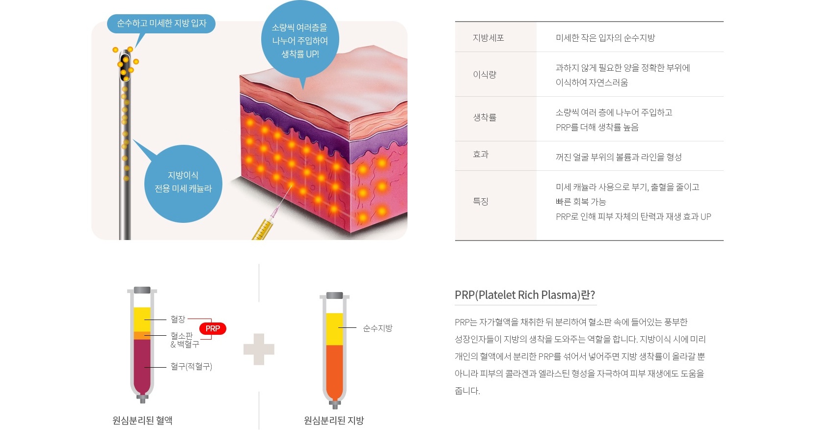 PRP 지방이식 생착률이 높은 이유 — 순수하고 미세한 지방 입자, 소량씩 여러층 주입, 지방세포·미세혈관 비교와 PRP란