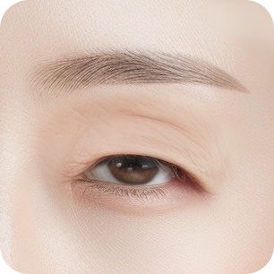 안검하수 유무 분석