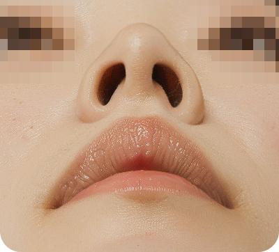 자연스러운 콧구멍 모양