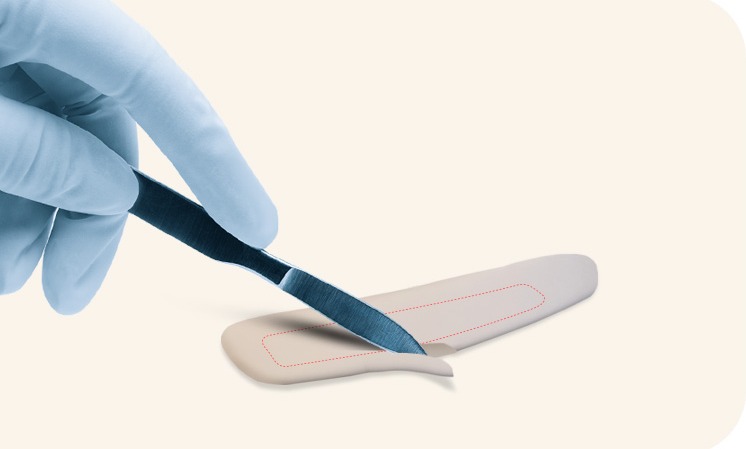 채취한 늑연골을 디자인하고 다듬는 모습