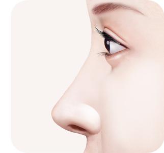 수술 후 — 알맞은 길이의 코라인으로 교정