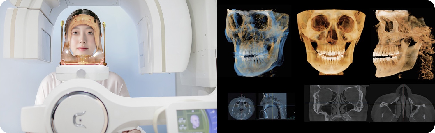 3D CT 촬영 모습과 두개골 입체 영상