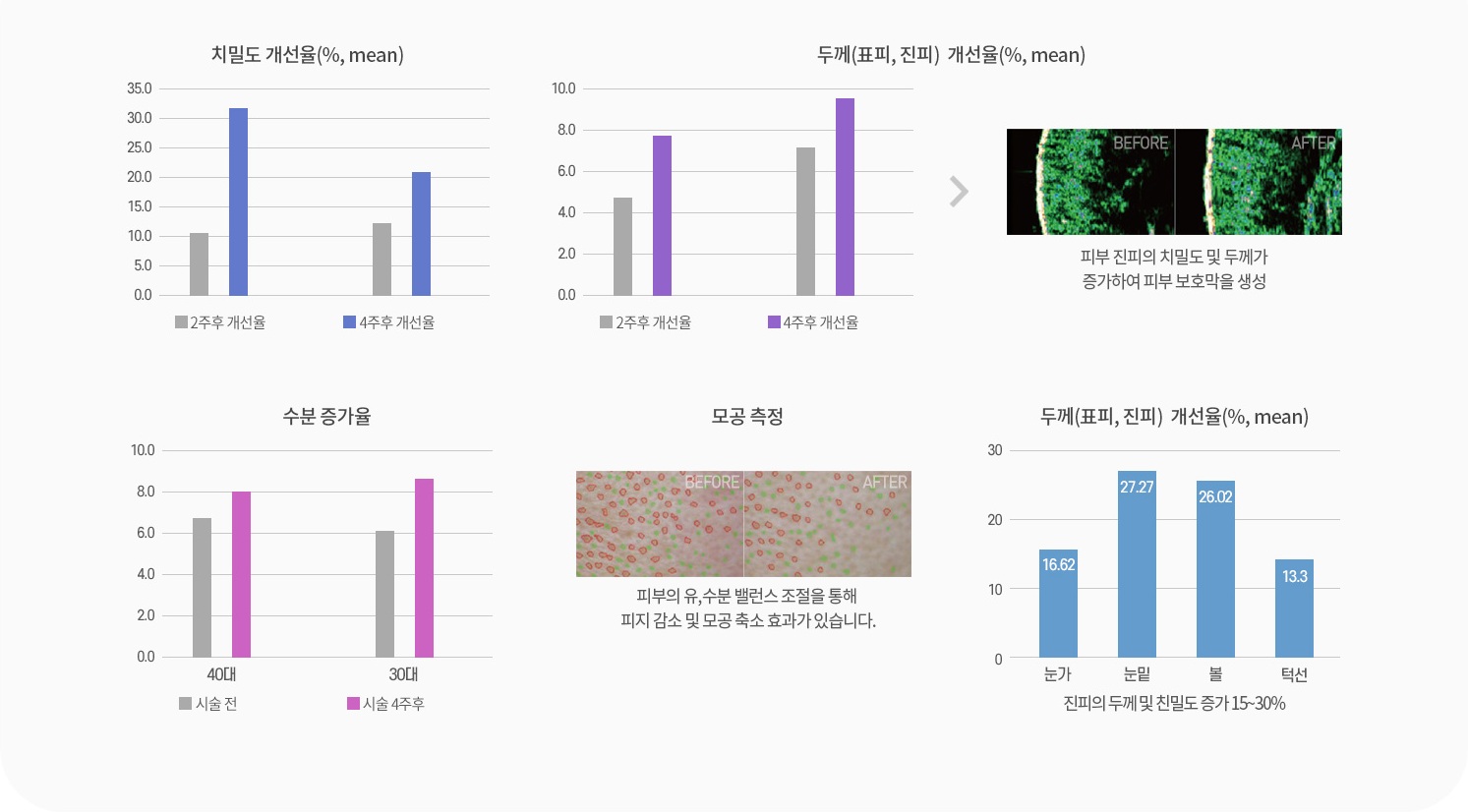 리쥬란힐러 임상 개선율 — 치밀도·두께·수분 증가율·모공 측정